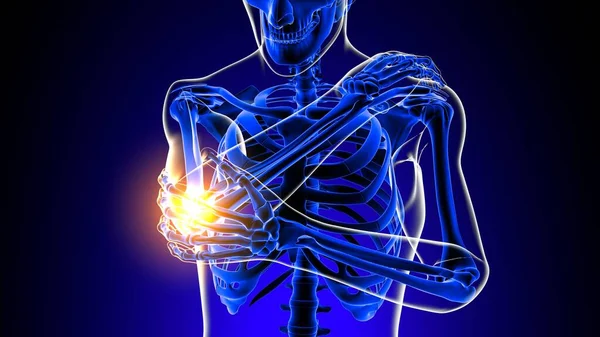 肘关节疼痛解剖的医学概念3D图解 — 图库照片