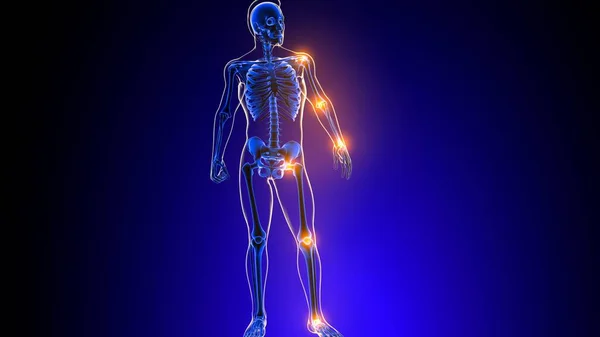 Human Skeleton Joint Pain Anatomy Medical Concept Illustration — Stockfoto