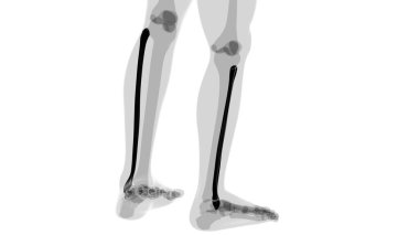 İnsan iskeleti anatomisi Fibula Kemiği Tıbbi Konsept için 3B Hazırlama