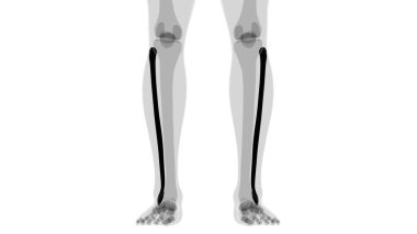 İnsan iskeleti anatomisi Fibula Kemiği Tıbbi Konsept için 3B Hazırlama