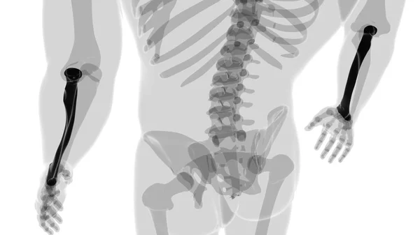 人体骨骼解剖学Radius骨三维成像医学概念 — 图库照片