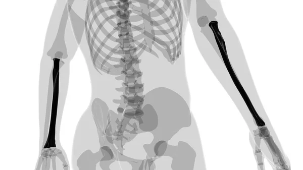 방사선 Bone Rendering Medical Concept — 스톡 사진