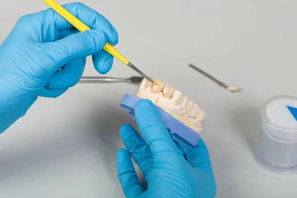 Yapay Diş Hekiminde Boyama Işini Diş Fırçasıyla Kapatın — Stok fotoğraf