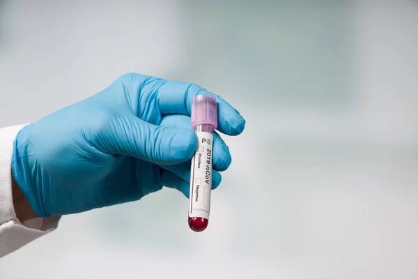 Mano Guanti Medici Con Una Provetta Del Sangue Test Del — Foto Stock