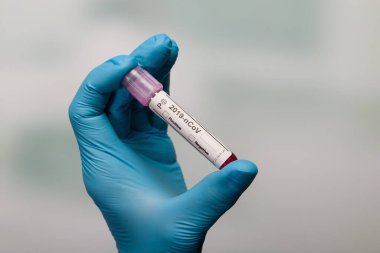 Corona virüs analizinden sonra ellerinde test tüpü tutan tıbbi eldivenlerle ellerinizi kapatın. 
