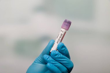 Ellerinizi tıbbi eldivenlerle kapatın ve virüs analizinden sonra test tüpü tutarak Omikron sonuç işaretleyicileri kullanın.