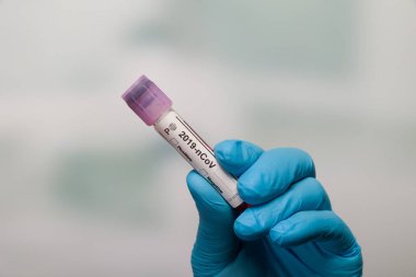 Ellerinizi tıbbî eldivenlerle kapatın ve virüs analizinden sonra test tüpü tutarak sonuç işaretleyicileri kullanın.