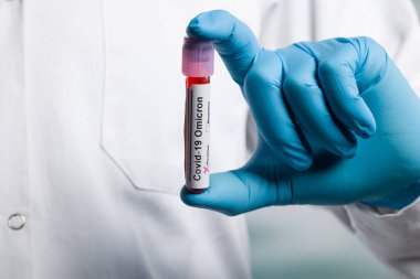 Ellerinizi tıbbi eldivenlerle kapatın. Virüs analizinden sonra kan testi tüpü ve omikron işaretleyicileri tutun.