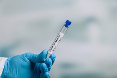 Ellerinizi tıbbi eldivenlerle kapatın ve virüs analizinden sonra test tüpü tutarak Omikron sonuç işaretleyicileri kullanın.