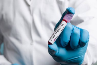 Ellerinizi tıbbi eldivenlerle kapatın ve virüs analizinden sonra test tüpü tutarak Omikron sonuç işaretleyicileri kullanın.