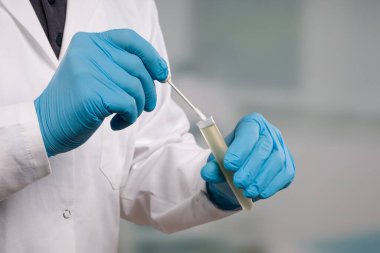 Coronavirus testi için tıbbi bir laboratuvarda yapılan leke testi için eldivenli ellerinizi kapatın.