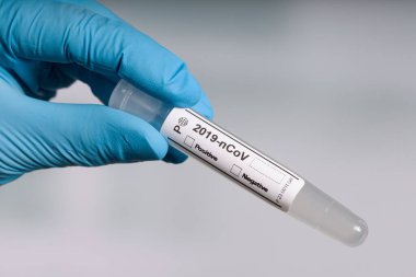 Mavi eldivenler içinde, laboratuarın önünde boş bir korona deney tüpü tutuyorlar.