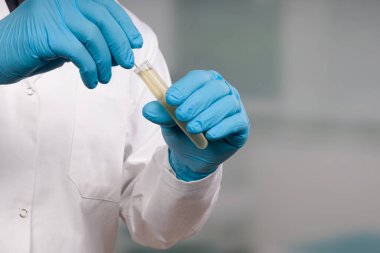 Coronavirus testi için tıbbi bir laboratuvarda yapılan leke testi için eldivenli ellerinizi kapatın.
