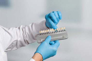 Diş beyazlatma ya da yapay diş implantı (implant) için diş kaplamasını kontrol etmek / belirlemek için gölgelik rehberli dişçi eli