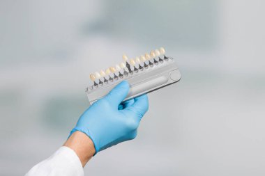 Diş beyazlatma ya da yapay diş implantı (implant) için diş kaplamasını kontrol etmek / belirlemek için gölgelik rehberli dişçi eli