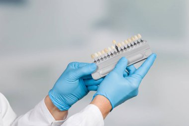 Diş beyazlatma ya da yapay diş implantı (implant) için diş kaplamasını kontrol etmek / belirlemek için gölgelik rehberli dişçi eli