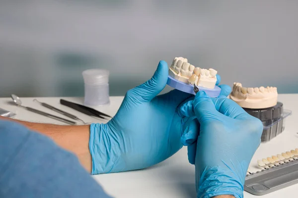 Diş Laboratuarındaki Takma Dişlerin Kalite Kontrolünün Kapatılması — Stok fotoğraf