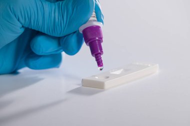 Corona ya da Covid-19 için antijen testi ya da hızlı test hazırlamaya yakın çekim 