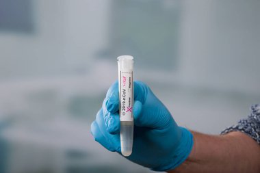 Ellerinizi tıbbî eldivenlerle kapatın. Virüs analizinden sonra Coronavirus 'a ait test tüpü tutuyorsunuz. 