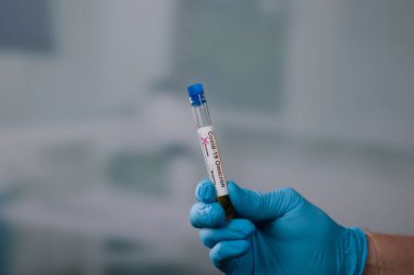 Ellerinizi tıbbi eldivenlerle kapatın ve virüs analizinden sonra test tüpü tutarak Omikron sonuç işaretleyicileri kullanın. 