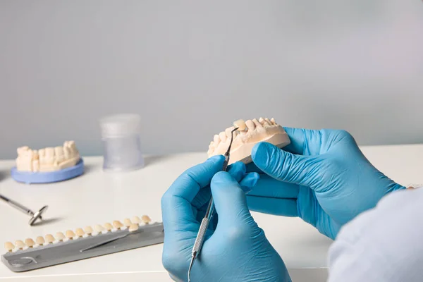 Крупним Планом Стоматолог Який Працює Над Коронкою Зуба Стоматологічній Лабораторії — стокове фото