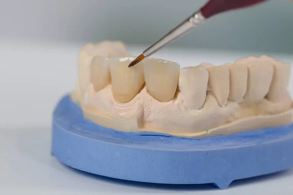 在牙科化验室用牙刷对假牙的油漆工作进行近距离观察 — 图库照片