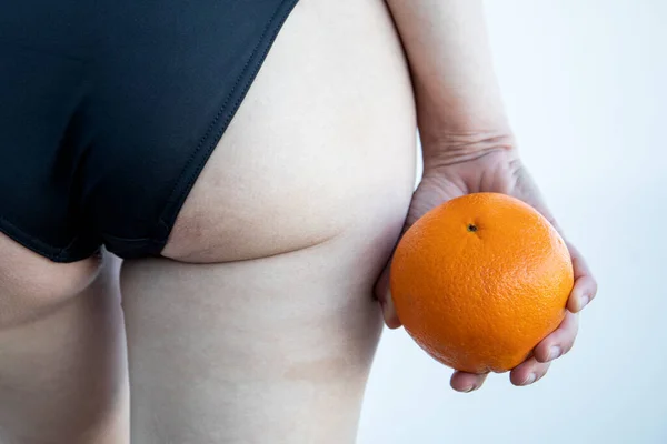 Cellulite or orange skin effect. Woman holding orange by her legs.