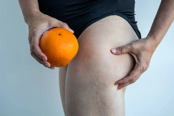 Female thighs and orange in hands. Concept of skin problems and beauty standards.