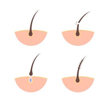 Saç problemi ikonu Sağlık ve Güzellik konsepti. İzole vektör illüstrasyonu