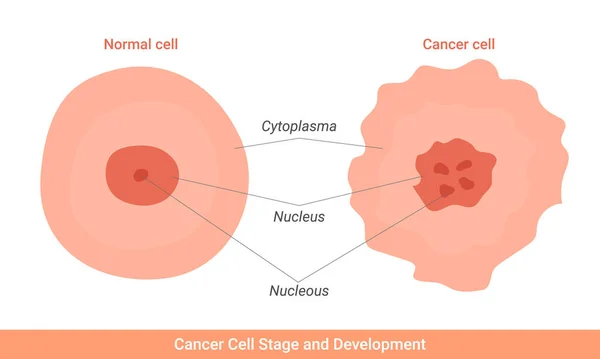 Cancer Cell Stage Development Illustration — стоковый вектор