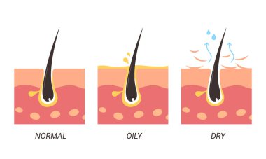 Normal, oily, and dry pores illustration