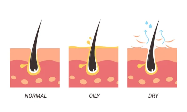 Normal Oily Dry Pores Illustration — 스톡 벡터