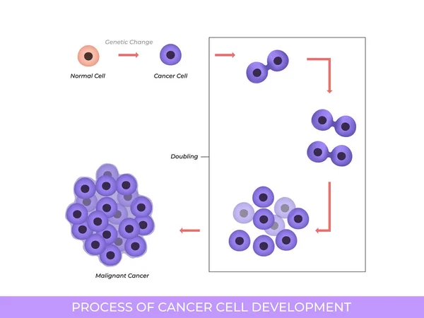 Ilustración Del Proceso Desarrollo Células Cancerosas — Vector de stock