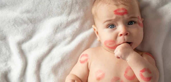 Vrolijke Baby Met Sporen Van Kussen Het Lichaam Valentijnsdag Concept — Stockfoto