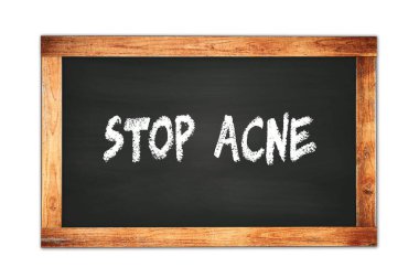 Siyah ahşap çerçeve okul tahtasına yazılmış ACNE DUR metni.
