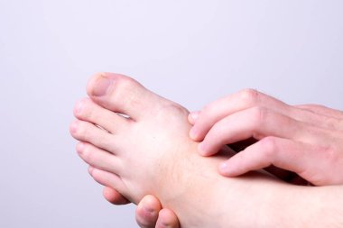 Bir adamın bacağındaki ameliyat sonrası iyileşmiş yara izi.