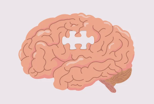 Cerveau Humain Avec Espace Forme Puzzle Illustration Sur Démence Maladie — Image vectorielle