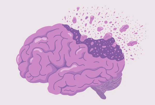 Músculo Del Cerebro Estalla Convierte Pequeño Golpe Polvo Aire Ilustración — Vector de stock