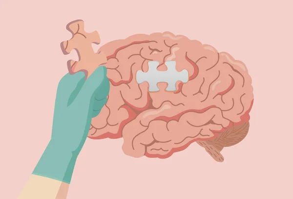 Tangan Dokter Dengan Sarung Tangan Memegang Jigsaw Otak Untuk Menambahkannya - Stok Vektor
