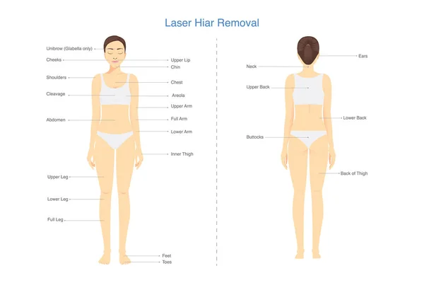 Populära Punkter Där Laser Hårborttagning Behandlingar Folkets Kroppsyta Illustration Laserklinikdiagram — Stock vektor