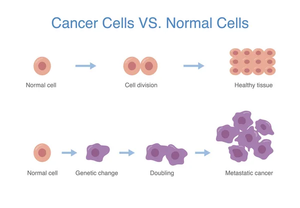 Compare Entre Devenlop Células Sanas Células Cancerosas Crecen Diagramas Médicos — Archivo Imágenes Vectoriales