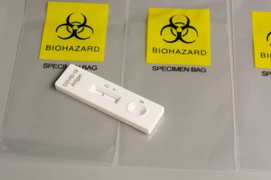 COVID-19 hastalığı için test kiti. Laboratuvar kartı test sonuçları koronavirüs virüsü için negatif çıktı.