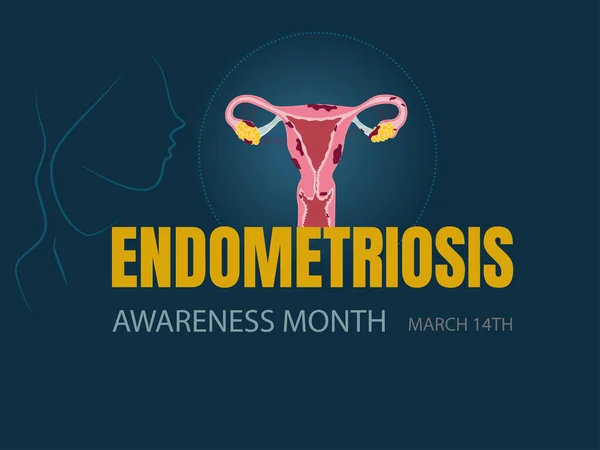 Vectorial Illustration Endometriosis Awareness March — Stock Vector