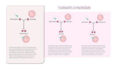 Turner sendromu olsun ya da olmasın sperm ve yumurta bilgileri.
