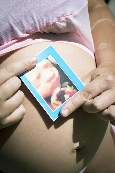 7个月大的孕妇肚子里有超声波粉色连衣裙的颜色 — 图库照片