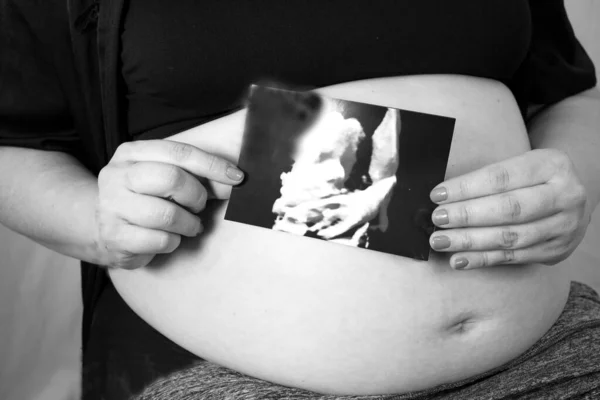 Åttonde Månaden Gravid Kvinna Med Ultraljud Baby Ingen Kopieringsplats — Stockfoto