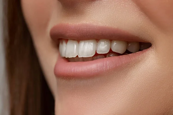 美丽的女性嘴的特写。牙科保健 — 图库照片