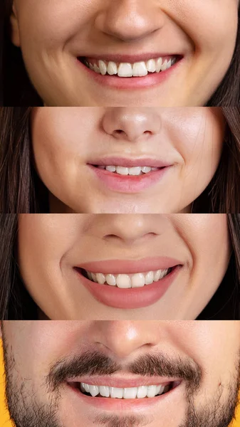 Collage. Imágenes con bocas masculinas y femeninas sonrientes colocadas en estrechas franjas horizontales —  Fotos de Stock