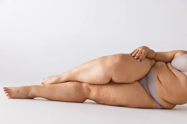 Cropped Image Female Legs Isolated Grey Studio Background Body Positivity — Stock Photo, Image
