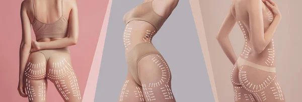 Collage Cropped Female Body Buttocks Legs Underwear Arrow Symbols Isolated — Foto Stock